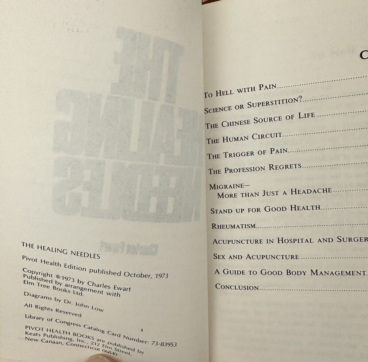 The Healing Needles - Charles Ewart, 1973 - Immaculate Vintage Copy - Image 1